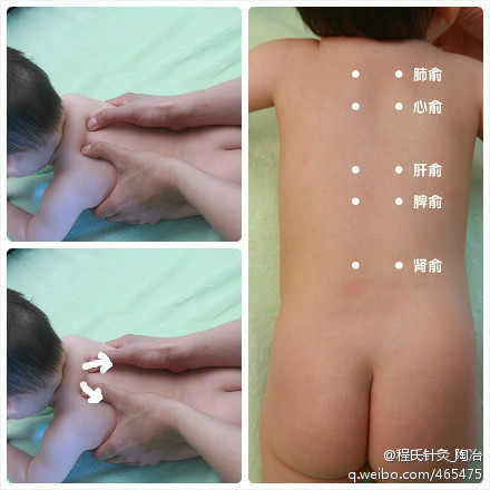 psb.jpg肺腧.jpg